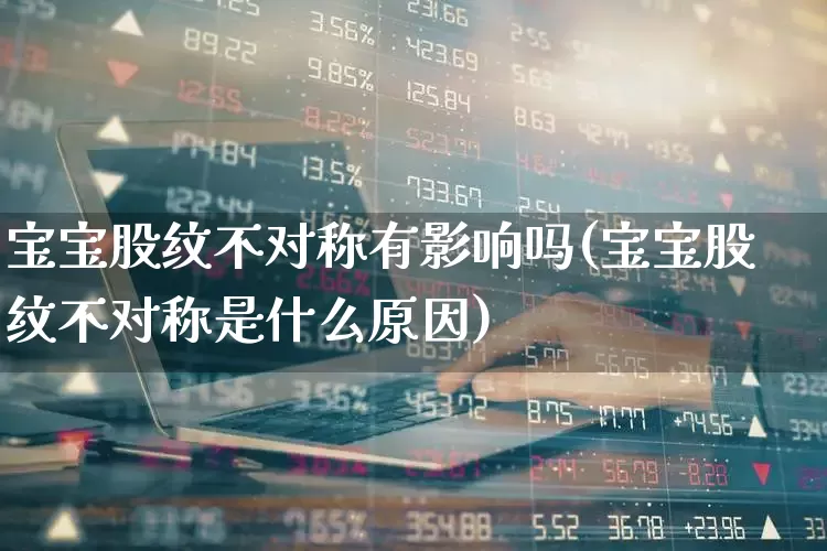 宝宝股纹不对称有影响吗(宝宝股纹不对称是什么原因)_https://www.gfdzclz.com_深交所_第1张